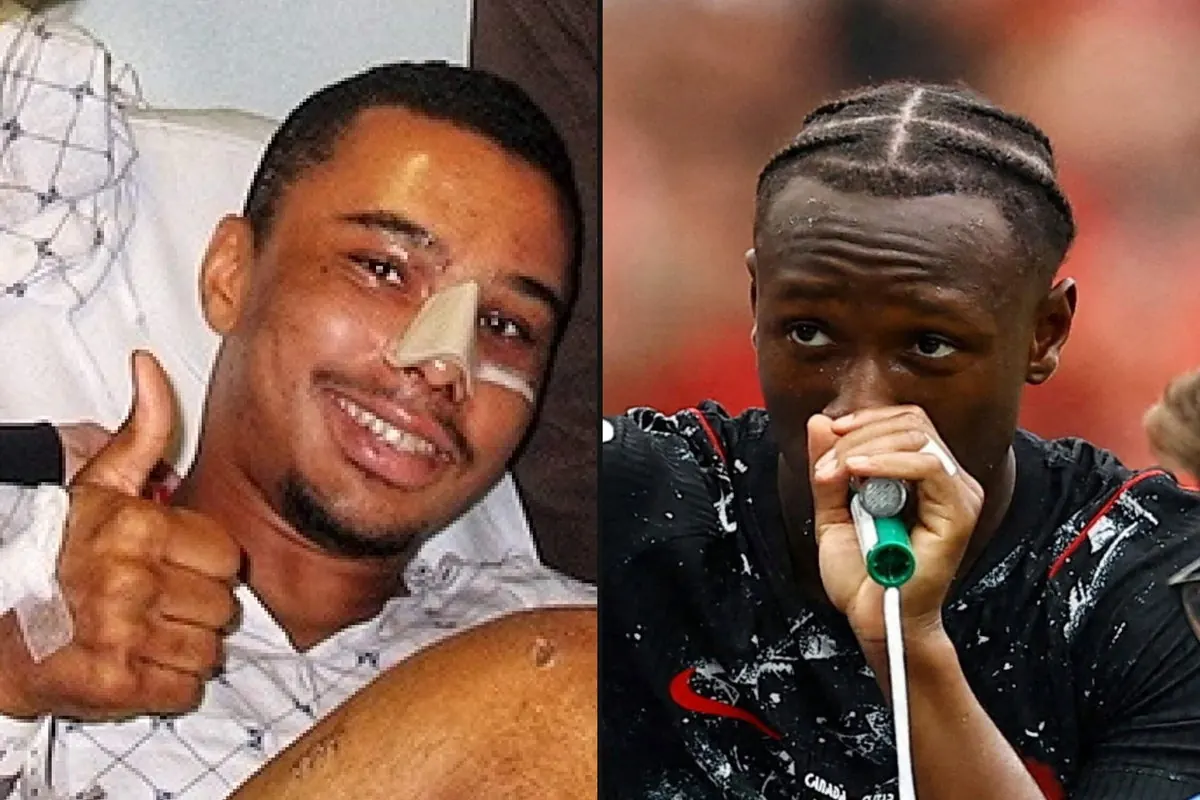 Photo collage showing Charlie Davies after his injury and Ismaël Koné after his injury during a World Cup match.